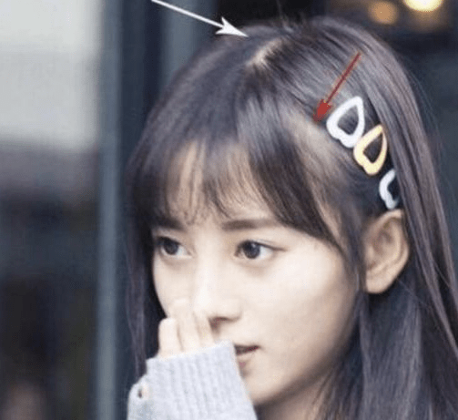 “BJL平台”
为什么女明星头发都浓密看不见发缝？刘亦菲是天生 鞠婧祎是心机(图12)